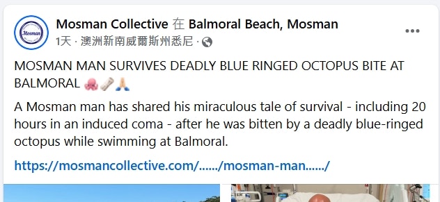 澳洲一名43歲男子在悉尼海邊游泳時被號稱世上最毒的「藍環章魚」螫咬，差點喪命。（Facebook@mosmancollective）