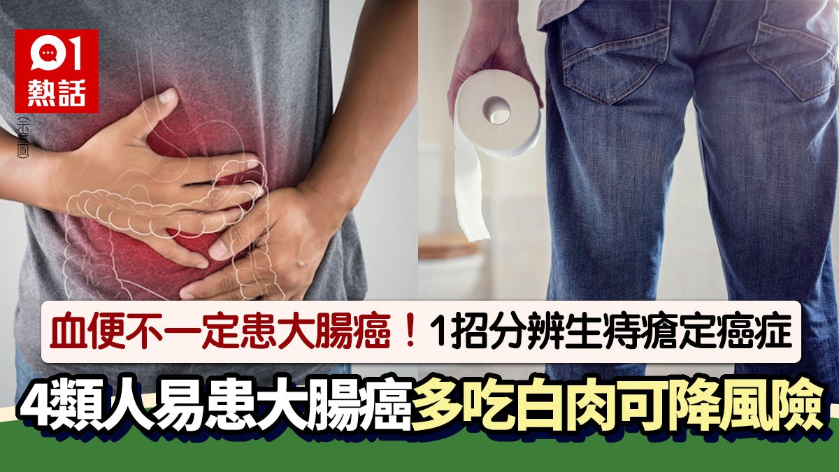 有血便等於患大腸癌?醫生教1招分辨患痔瘡定癌症 4類人風險高 有血便等於患大腸癌?醫生教1招分辨患痔瘡定癌症 4類人風險高