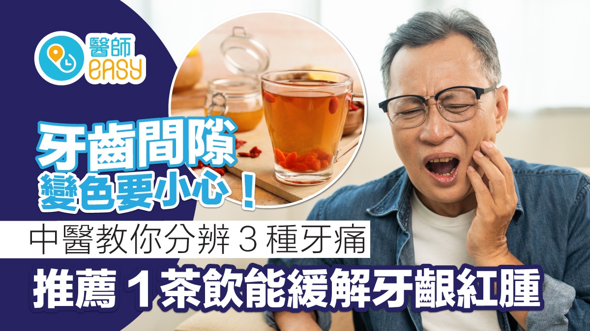 牙痛|牙齒間隙變黑要小心蛀牙!中醫分3種牙痛1茶飲緩解牙齦紅腫 牙痛|牙齒間隙變黑要小心蛀牙!中醫分3種牙痛1茶飲緩解牙齦紅腫