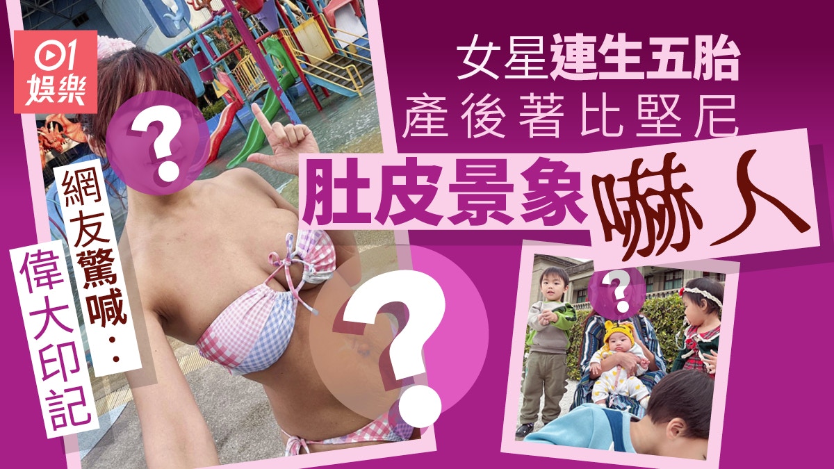 女星連生五胎產後著比堅尼嚇人景象　網友驚喊︰偉大印記