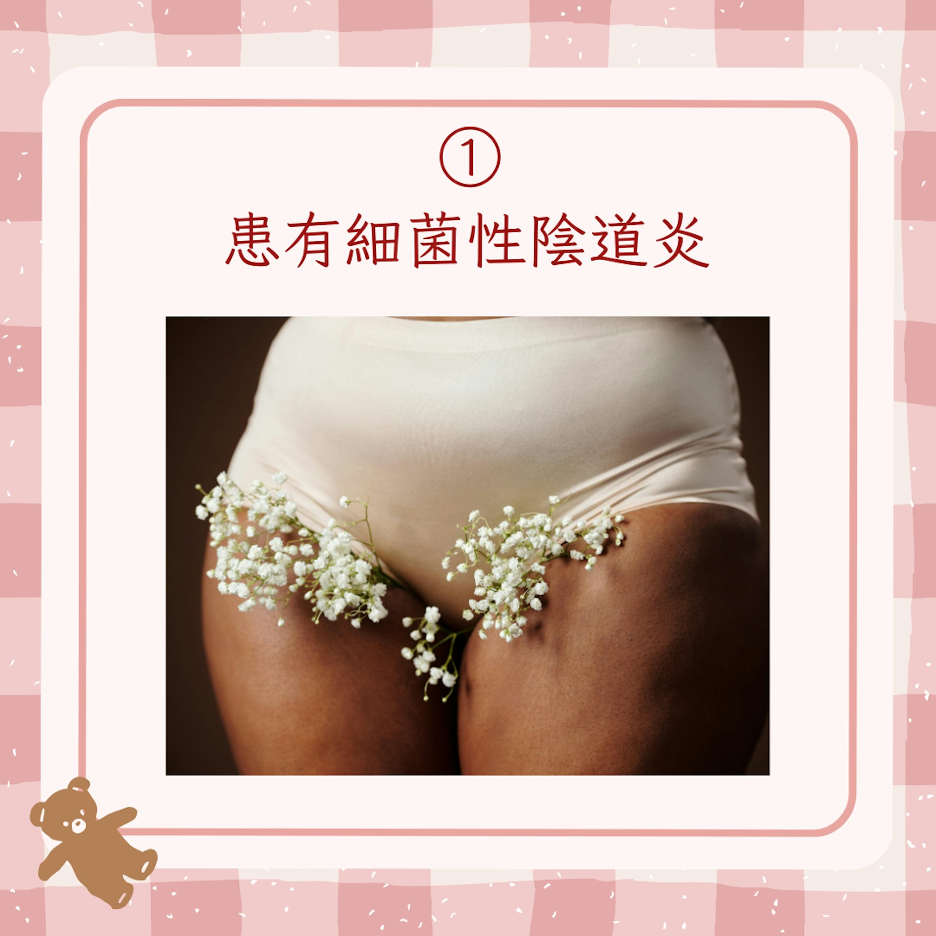 【女性私密處異味6大成因+改善方法】1. 患有細菌性陰道炎(pexels@Cliff Booth;01製圖) 【女性私密處異味6大成因+改善方法】1. 患有細菌性陰道炎(pexels@Cliff Booth;01製圖)