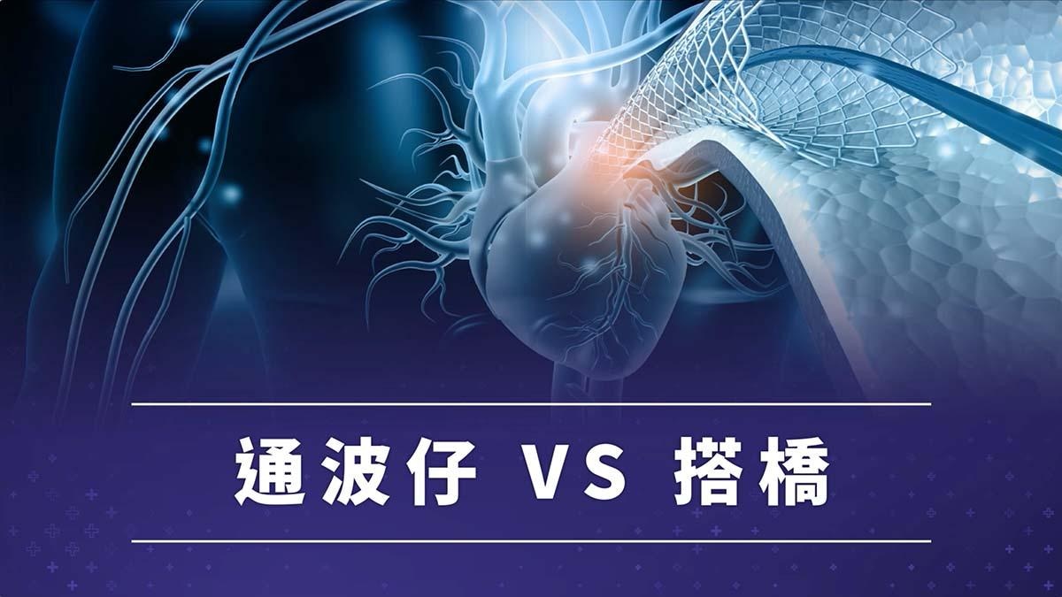 醫心直說|心臟手術點揀好?通波仔定搭橋?醫生為你專業分析