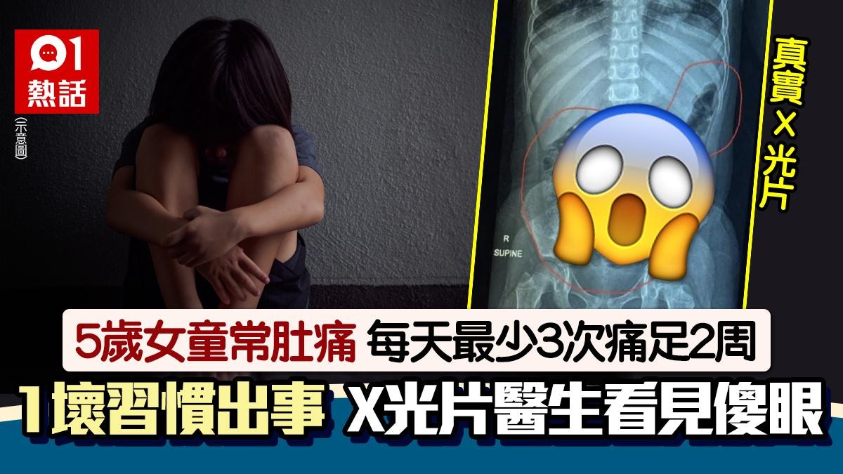 Child’s Severe Constipation: X-Ray Reveals Shocking Cause