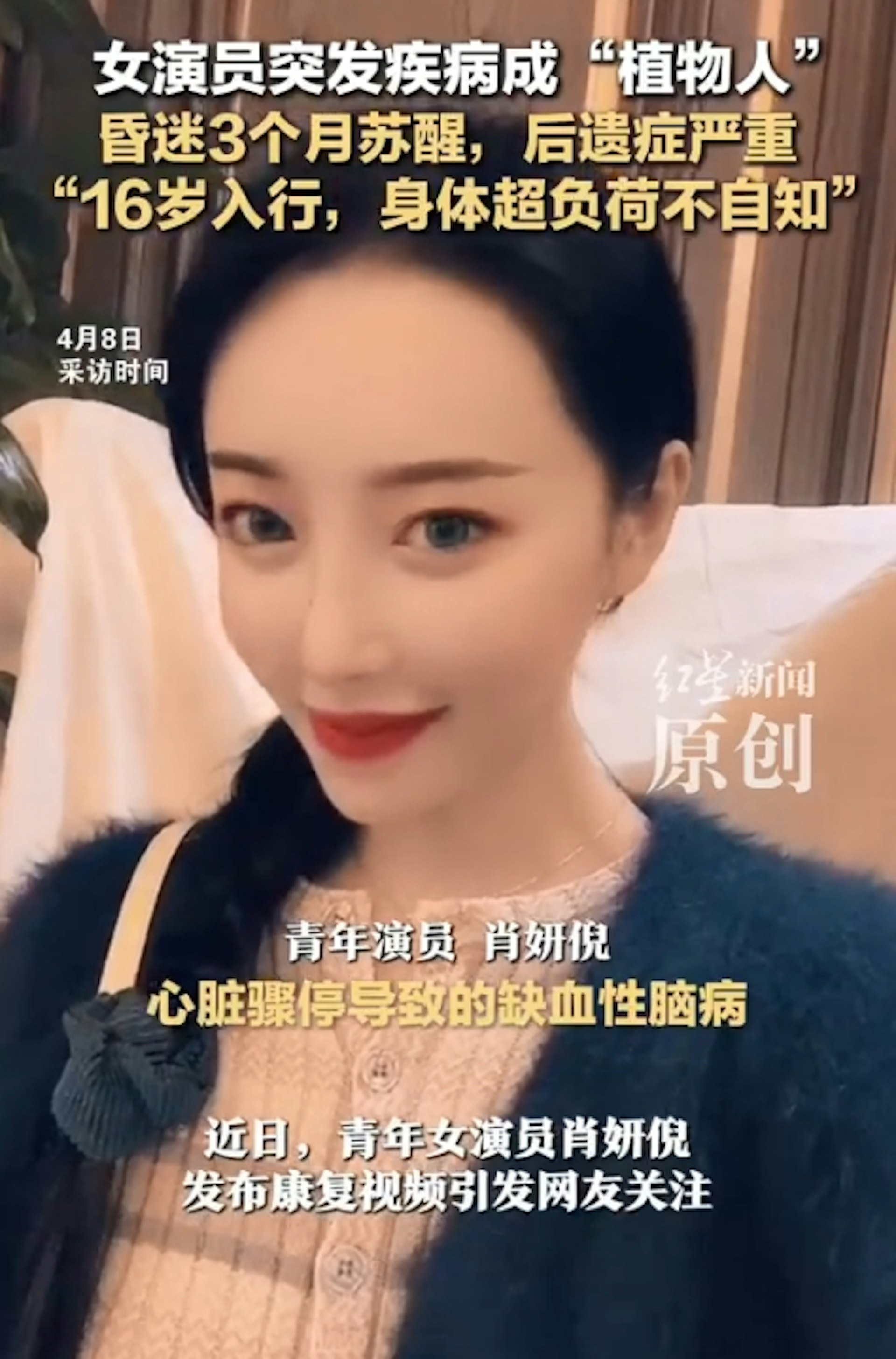 內地女演員肖妍倪近日受訪提及自己3年多前突然心臟驟停,急救後成植物人,沒想到3個月後奇蹟甦醒。(微博影片截圖) 內地女演員肖妍倪近日受訪提及自己3年多前突然心臟驟停,急救後成植物人,沒想到3個月後奇蹟甦醒。(微博影片截圖)