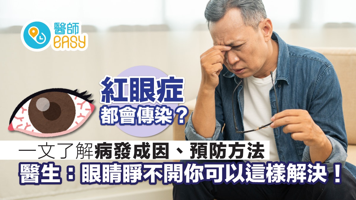 眼睛健康|紅眼症流行季來臨?醫生盤點這些眼疾恐致眼睛紅腫癢痛 眼睛健康|紅眼症流行季來臨?醫生盤點這些眼疾恐致眼睛紅腫癢痛
