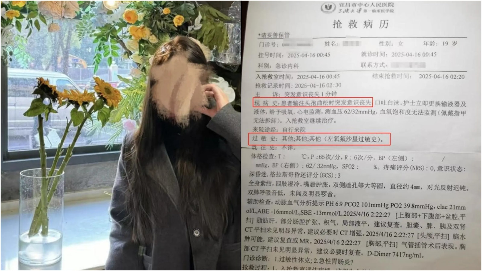 19歲女吊鹽水輸頭孢過敏亡 家屬質疑未做皮試兼醫護不在場釀悲劇 19歲女吊鹽水輸頭孢過敏亡 家屬質疑未做皮試兼醫護不在場釀悲劇