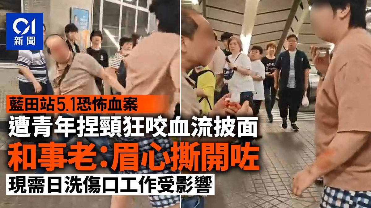 藍田站血案｜被咬傷者剖白「眉心撕開咗」　工作受影響籲街坊小心