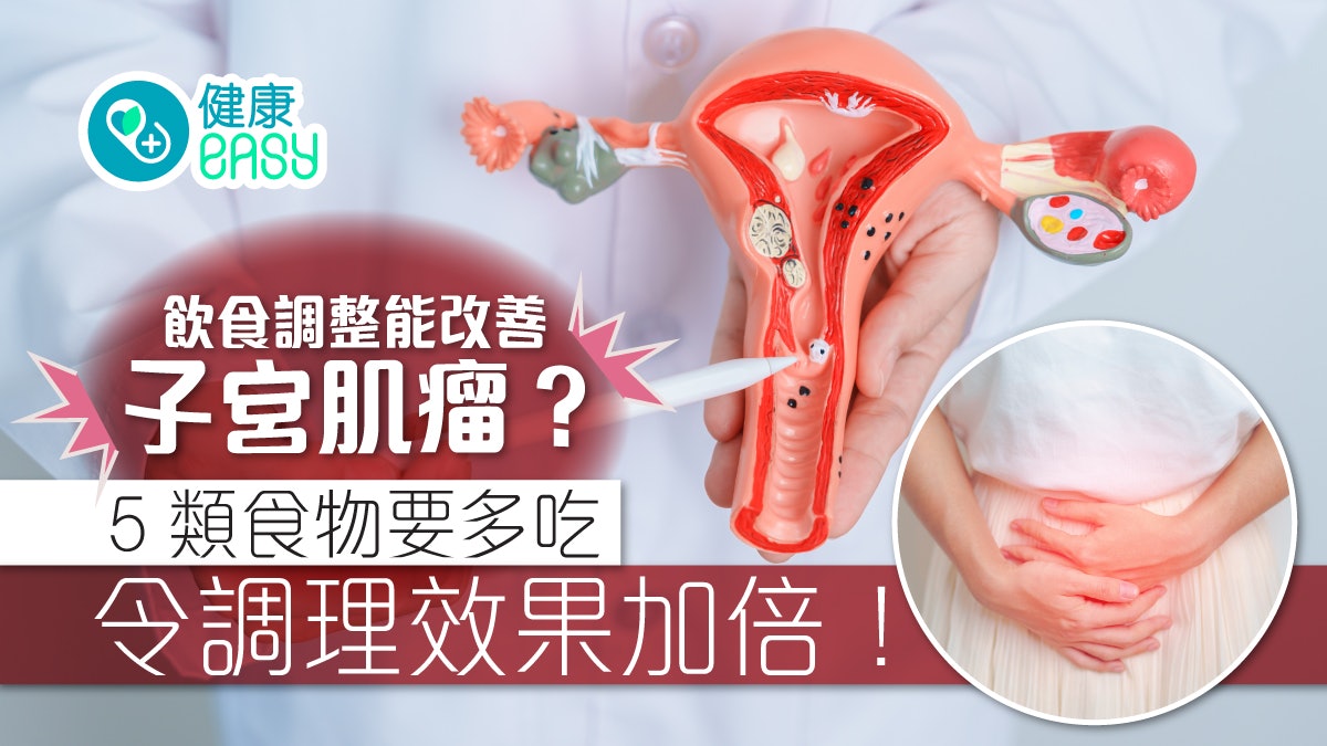 調整飲食可以改善子宮肌瘤?多吃5類食物降低發炎有助抑制肌瘤 調整飲食可以改善子宮肌瘤?多吃5類食物降低發炎有助抑制肌瘤
