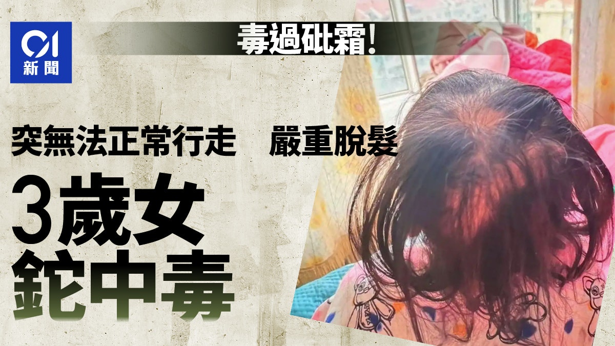 毒過砒霜!3歲女童突嚴重脫髮 被確診鉈中毒 警調查為人為投毒 毒過砒霜!3歲女童突嚴重脫髮 被確診鉈中毒 警調查為人為投毒