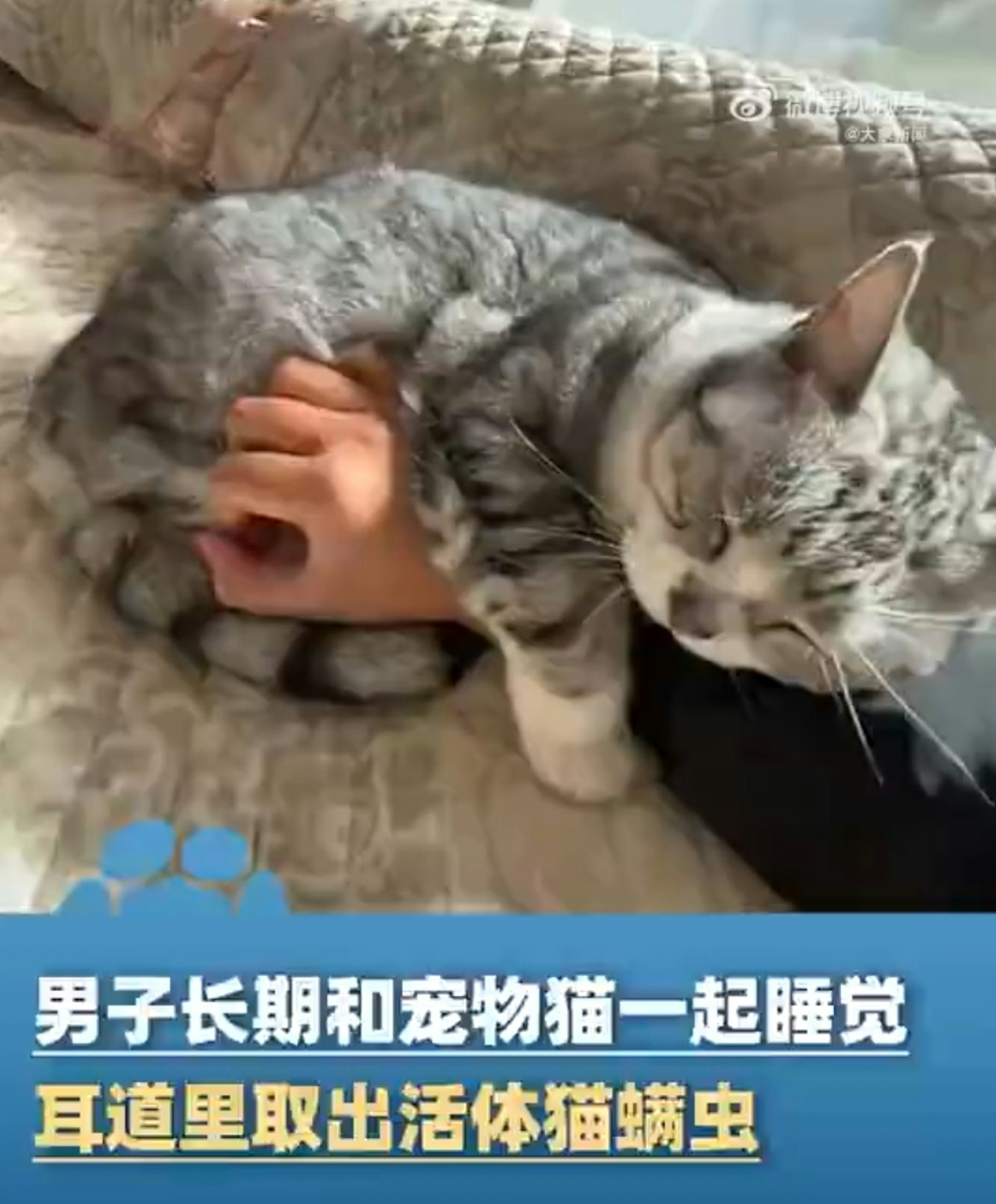 武漢一名養貓男子左耳不時聽到「沙沙」異響,就醫赫然發現耳膜上附著一隻活體貓蟎蟲。(微博影片截圖) 武漢一名養貓男子左耳不時聽到「沙沙」異響,就醫赫然發現耳膜上附著一隻活體貓蟎蟲。(微博影片截圖)