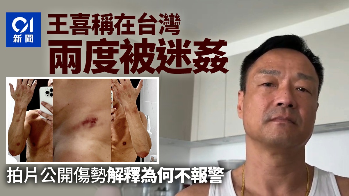 王喜稱在台灣兩度被迷姦疑似被人監視 拍片曬傷勢解釋為何不報警 王喜稱在台灣兩度被迷姦疑似被人監視 拍片曬傷勢解釋為何不報警