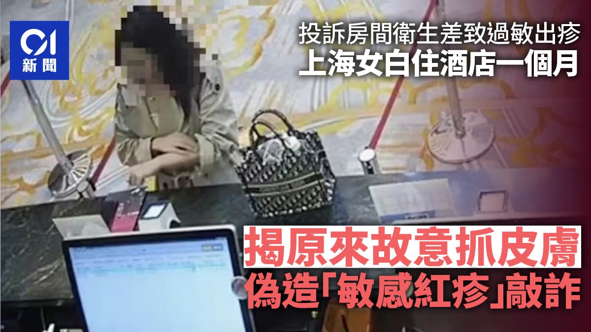 故意抓撓皮膚致敏　上海女靠虛構衛生問題白住一個月酒店被捕