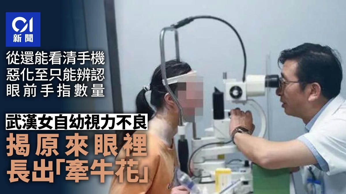 女子眼裡竟長出「牽牛花」　視力模糊「只能辨認眼前手指數量」