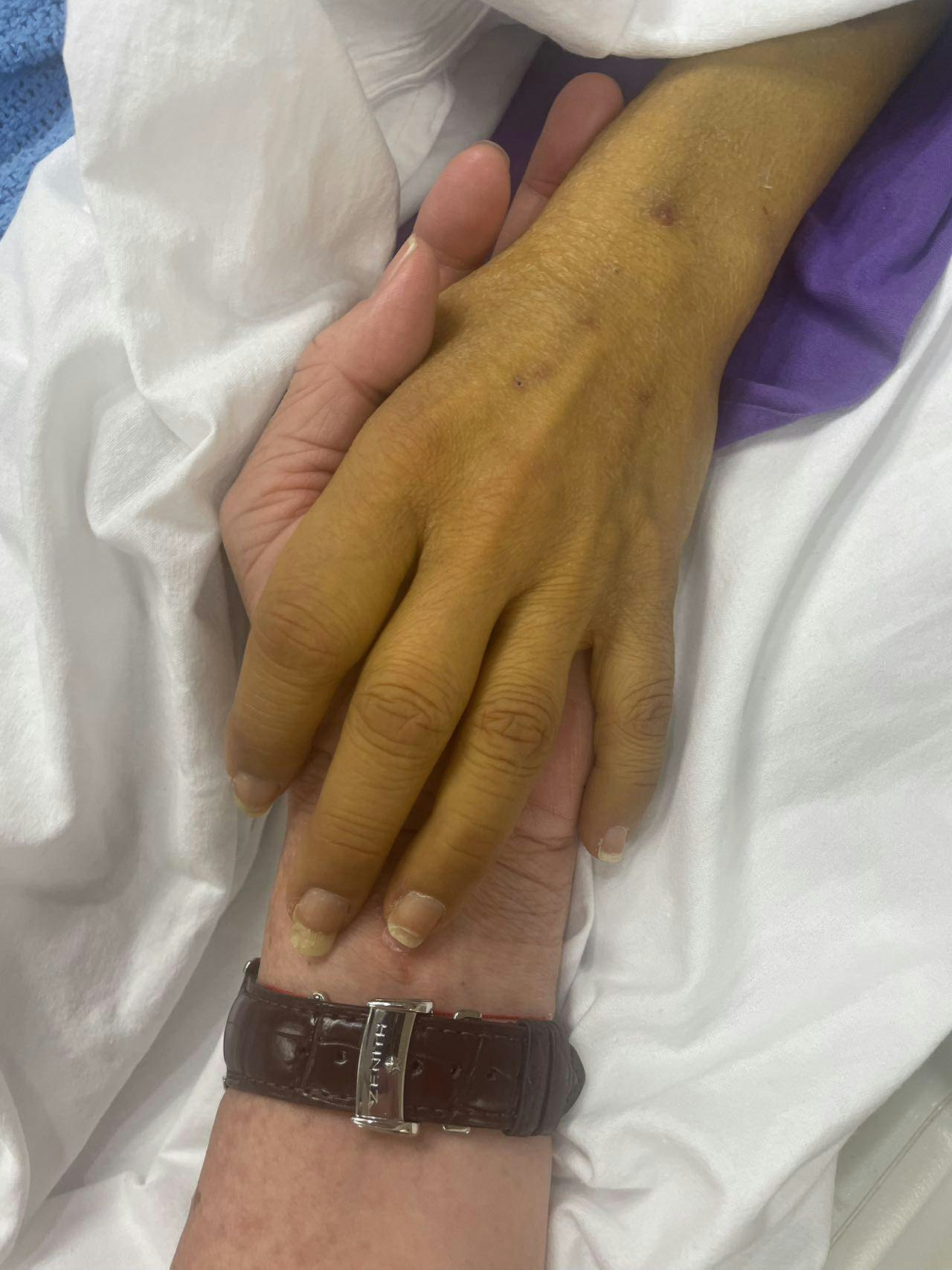 艾威上載與太太牽手照,身患肝病的Lisa皮膚呈深黃色並有些水腫。(facebook圖片)