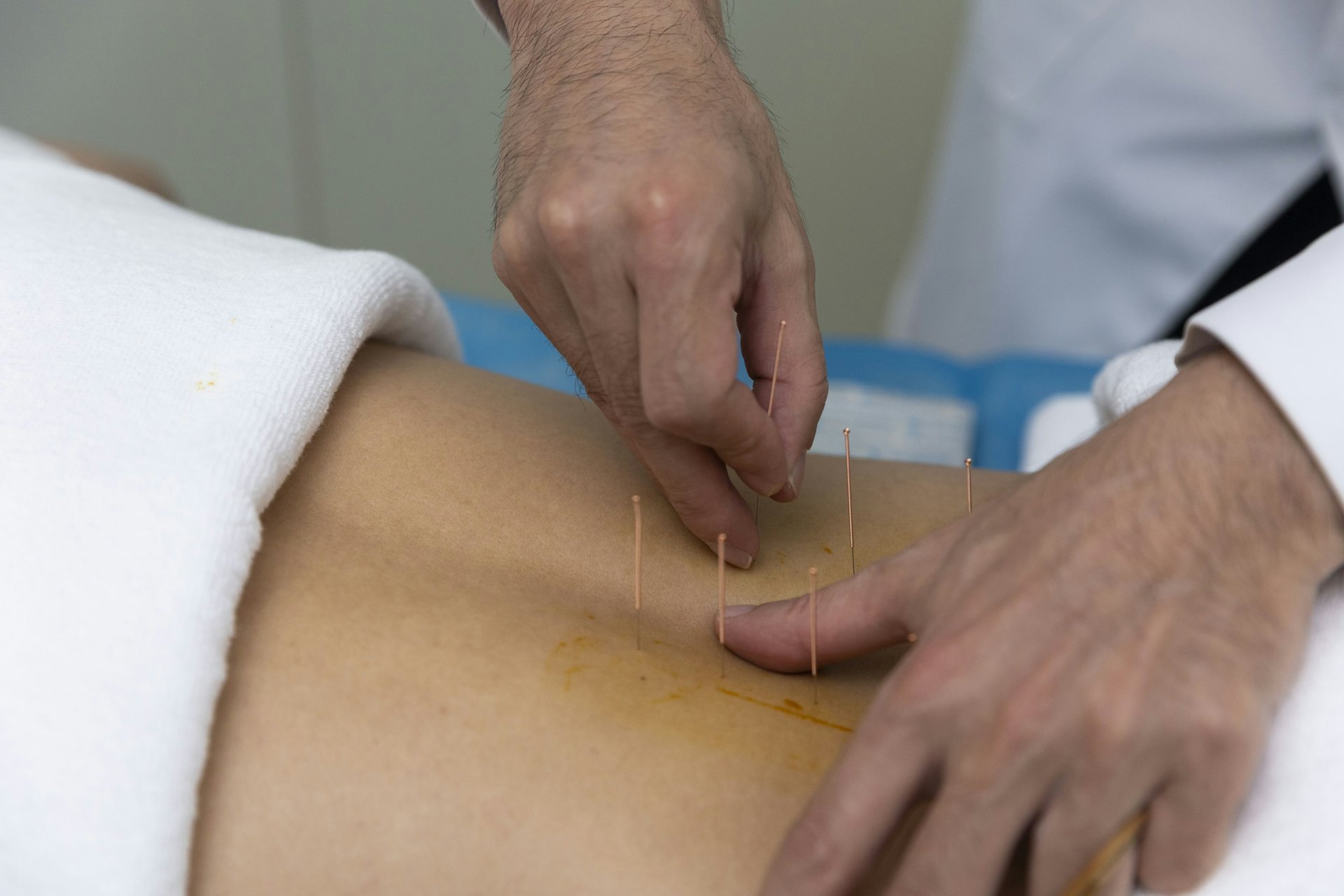 推拿針灸都由註冊中醫操刀,不怕愈按愈傷。