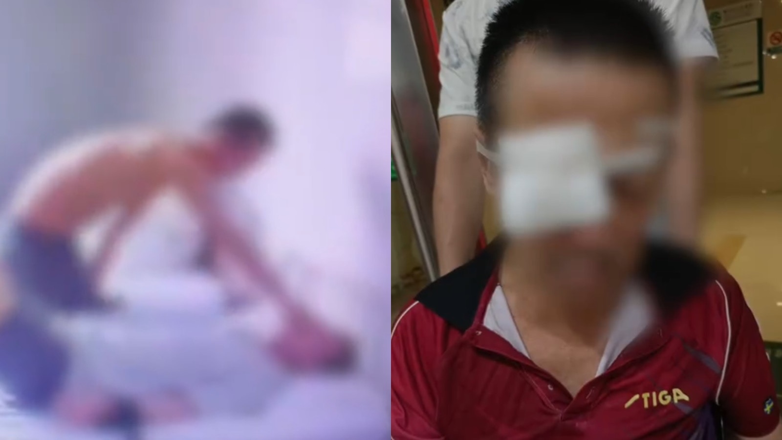 湖北68歲失智翁精神病院治療 慘遭病友挖出眼球致失明