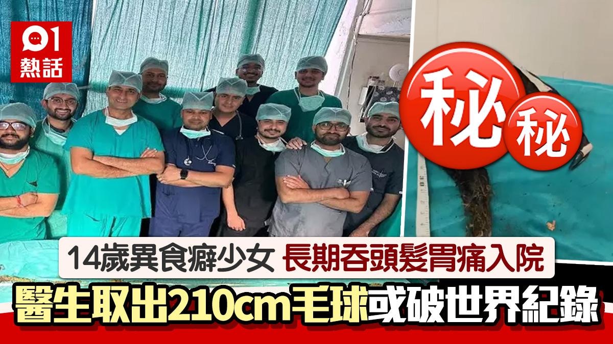 14歲少女胃痛嘔吐!入院剖腹取出210cm毛髮結石 或破世界紀錄