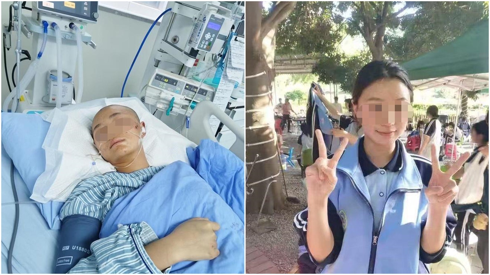 17歲女高考前一日遭貨車撞致腦部損傷入ICU 母:女兒已通過藝考