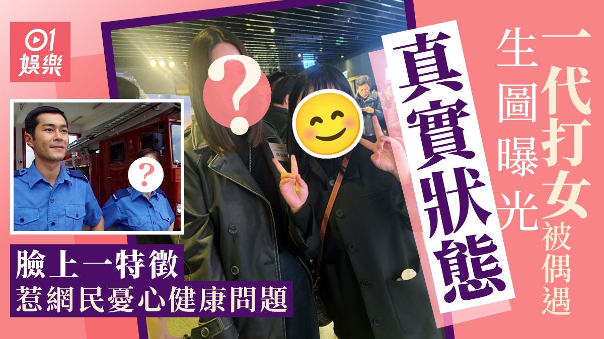 梁琤被偶遇生圖曝光真實狀態 臉上一特徵持續惹網民憂心健康