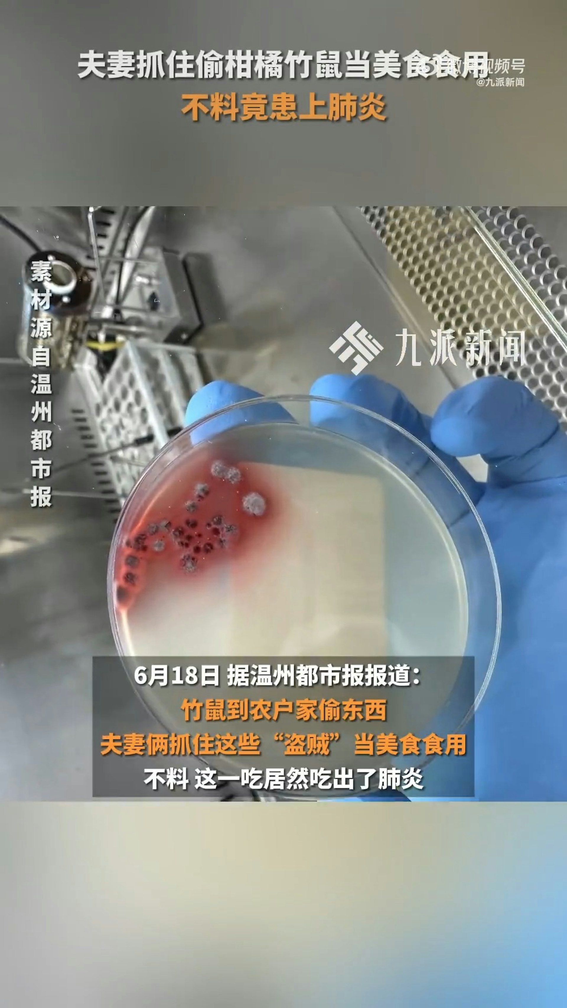 醫生經支氣管鏡檢查,發現該對夫婦是感染了「馬爾尼菲籃狀菌」導致肺炎。(微博影片截圖) 醫生經支氣管鏡檢查,發現該對夫婦是感染了「馬爾尼菲籃狀菌」導致肺炎。(微博影片截圖)