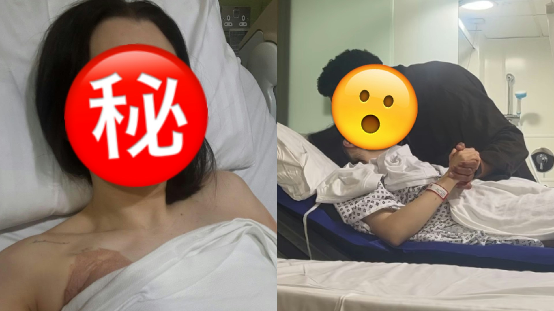 乳癌藝人手術後發放正能量　幽默談乳房重建笑住抗癌：以巨乳回歸
