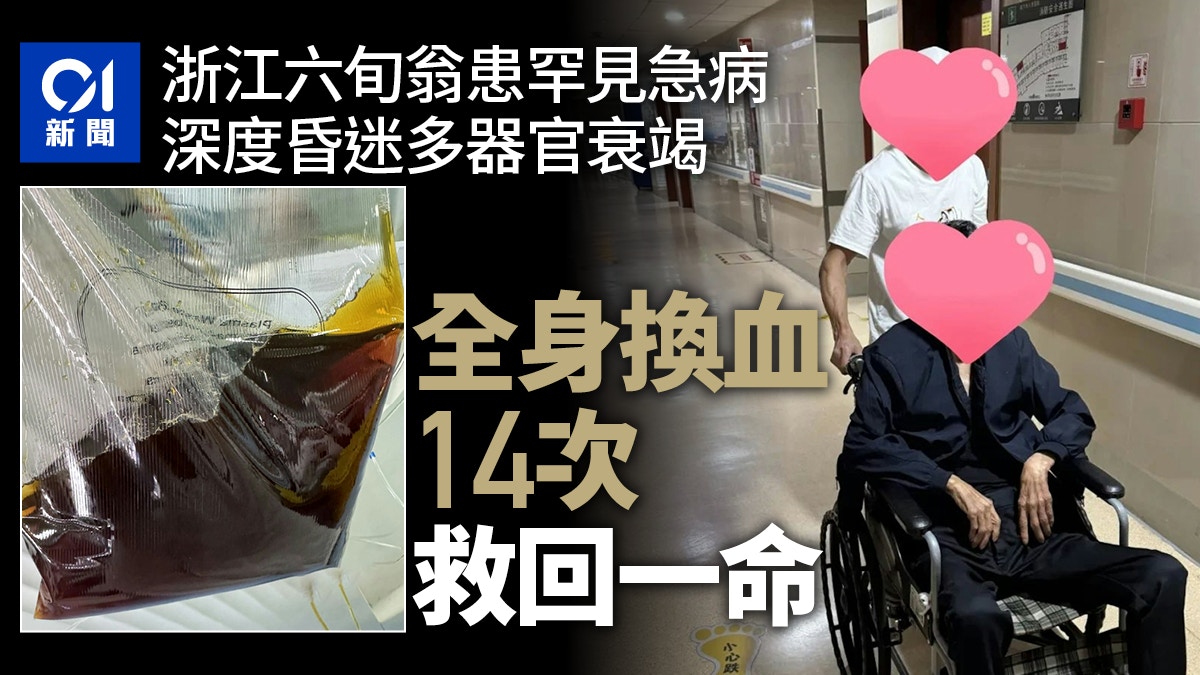 浙江六旬翁患罕見病多器官衰竭　全身換血14次轉危為安