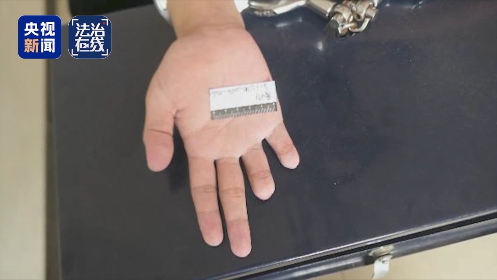 受害人员手指被剁。 (央视新闻)