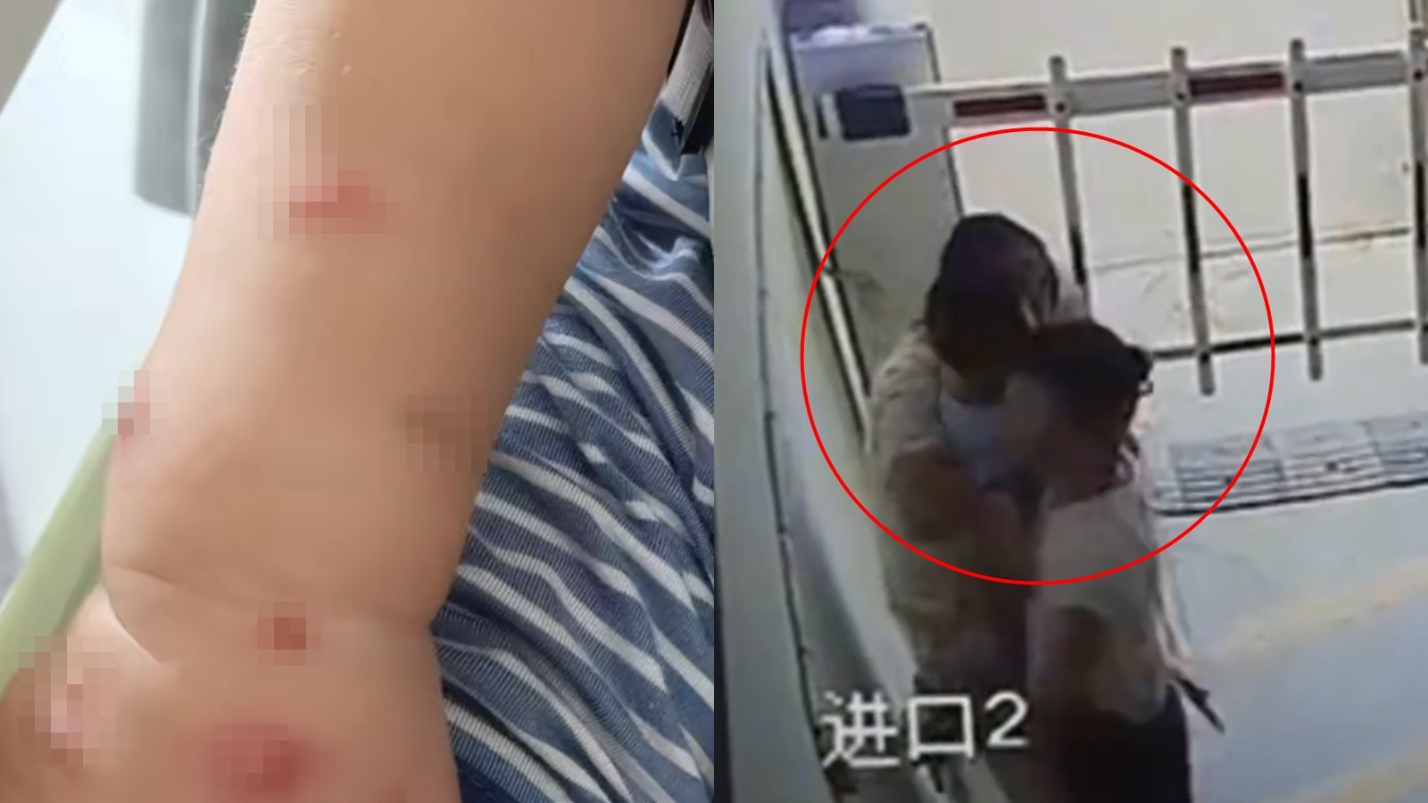 湖南1歲男童突遭陌生女強摟親吻　家屬稱男孩當晚高燒確診水痘