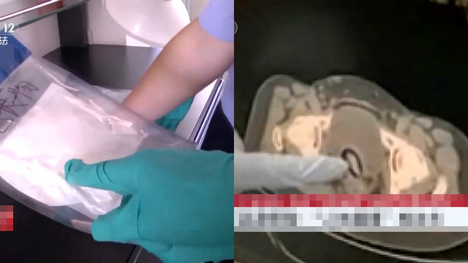 女子胸圍下體藏海洛英圖走私 羅湖斷正 海關監護排出白色塊狀物