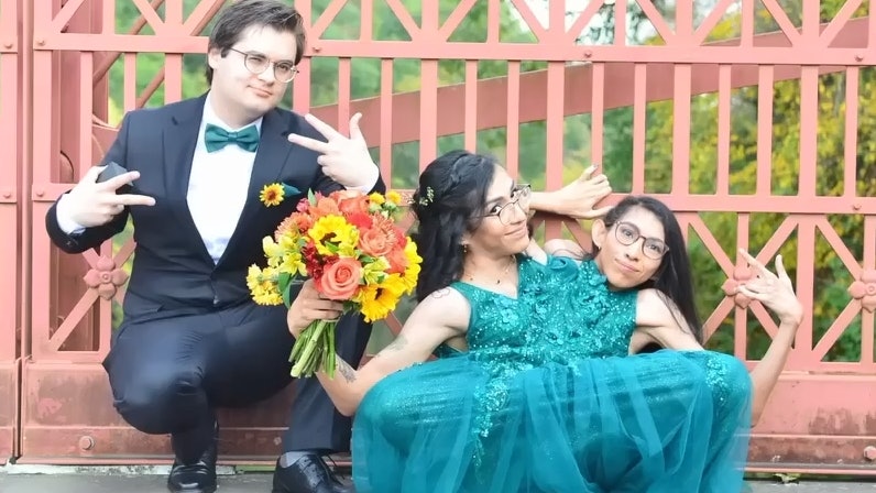 美國網紅連體嬰姊妹結婚了!「不是三人行」她堅持單身自稱無性戀