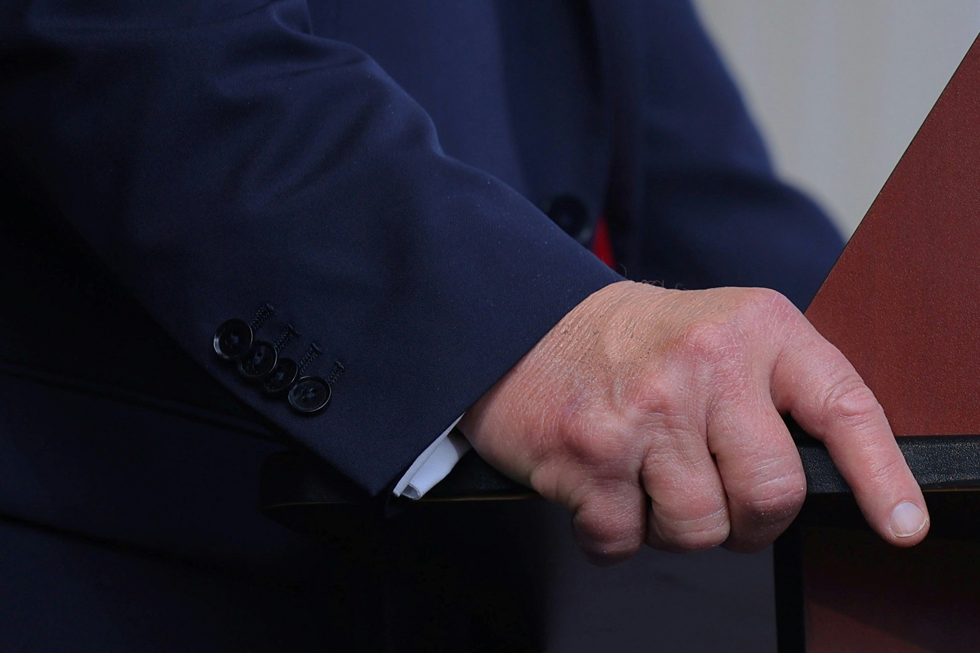 圖為2024年11月2日,時任美國總統候選人特朗普(Donald Trump)幢北卡羅來納州的競選集會上,被指以化妝遮蓋的右手手背。(Reuters) 圖為2024年11月2日,時任美國總統候選人特朗普(Donald Trump)幢北卡羅來納州的競選集會上,被指以化妝遮蓋的右手手背。(Reuters)