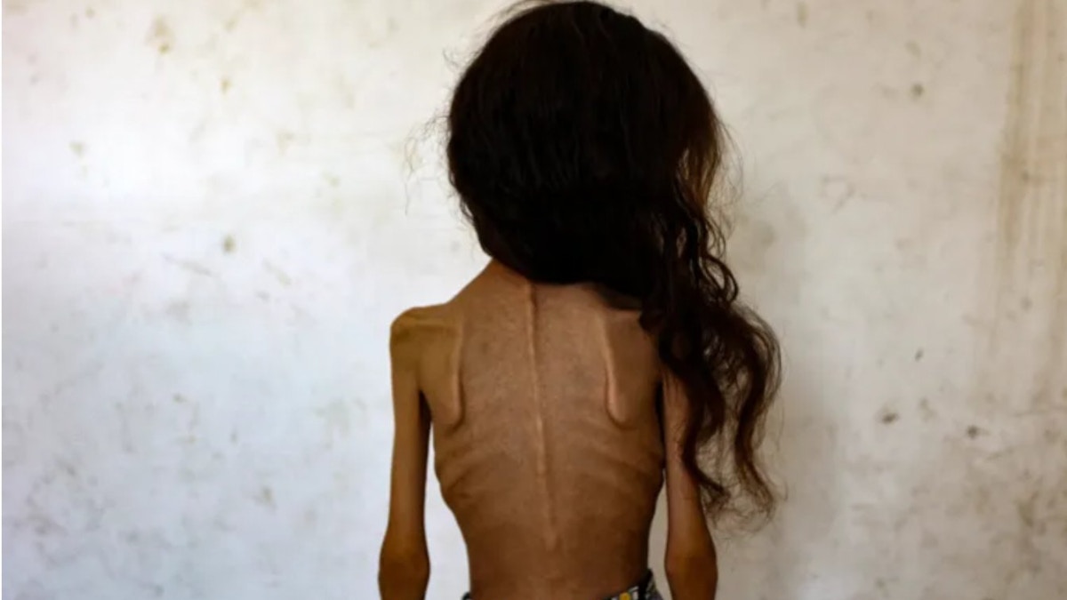 粮食权威机构指加沙爆发饥荒救助儿童会：儿童白日之下死于饥饿