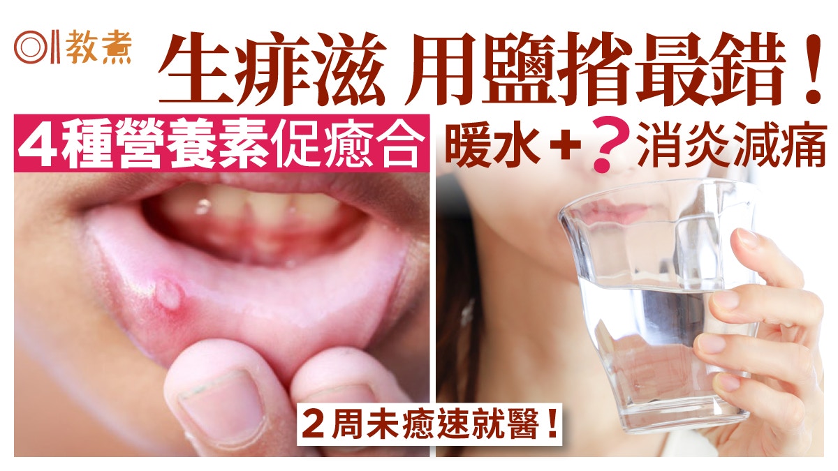 飛滋快好食物︳用鹽㨘最錯?4種營養素加快痱滋康復吃蛋、奇異果