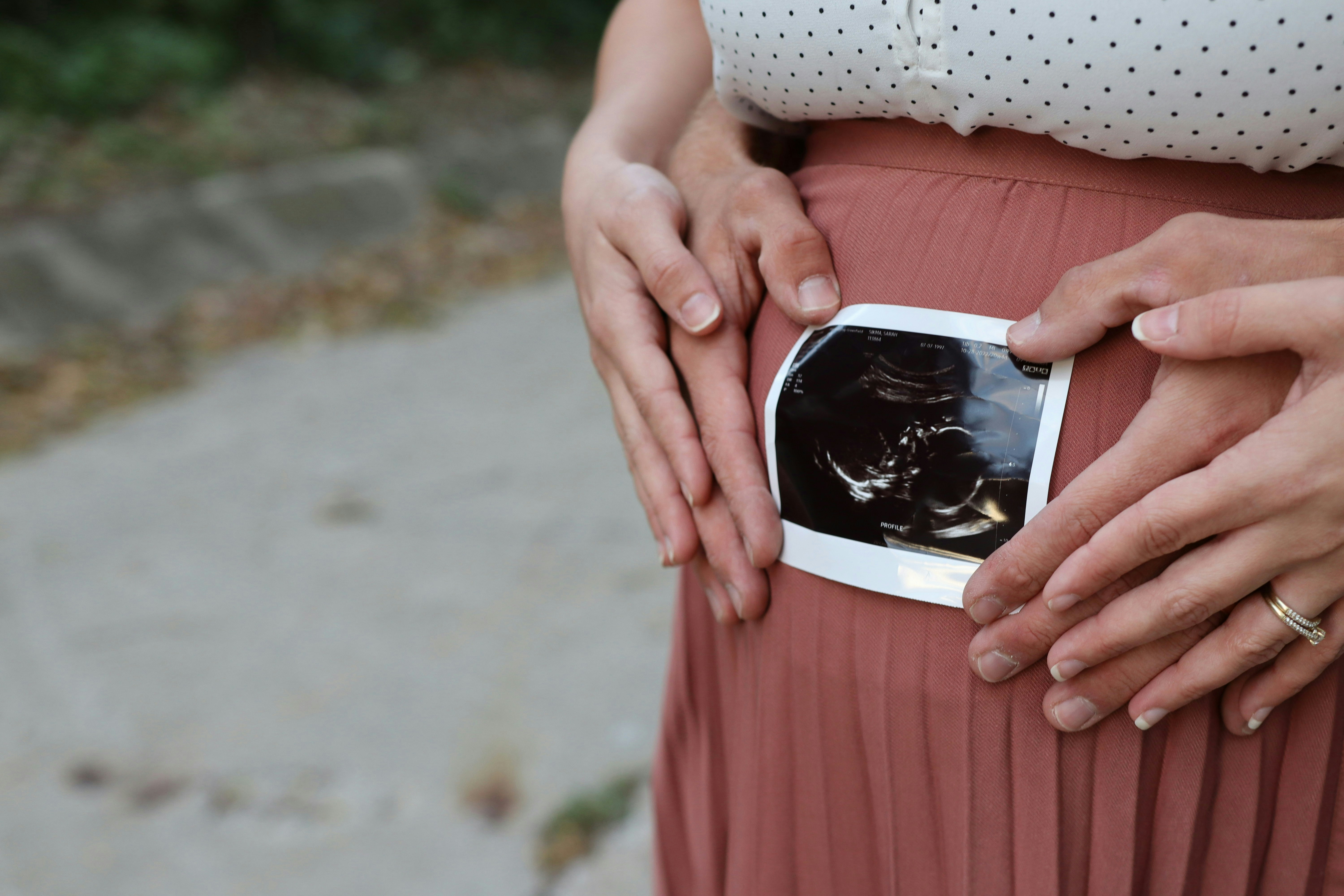 产检｜超声波检查准确度达6至8成！即睇各周数检查重点、代码意思