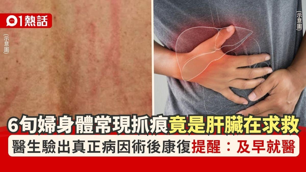 圖檔