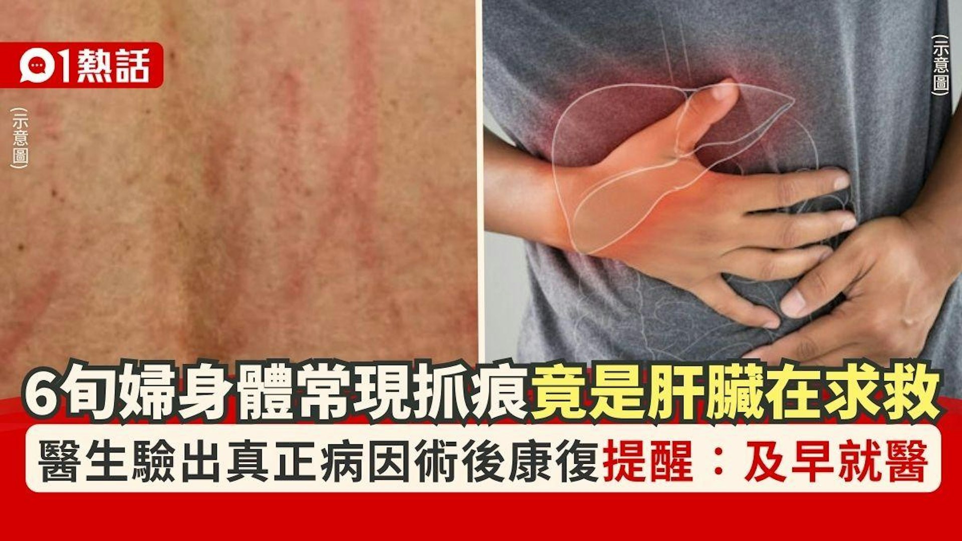 圖檔
