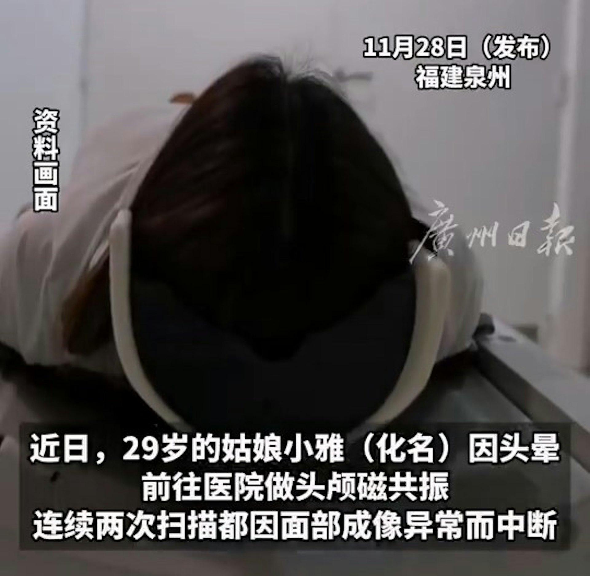女生做磁力共振兩次失敗洗臉后才完成 元兇竟是…