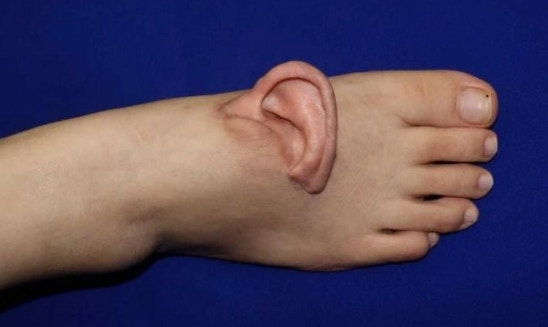 「寄養耳」在腳背上。(新藥說) 「寄養耳」在腳背上。(新藥說)