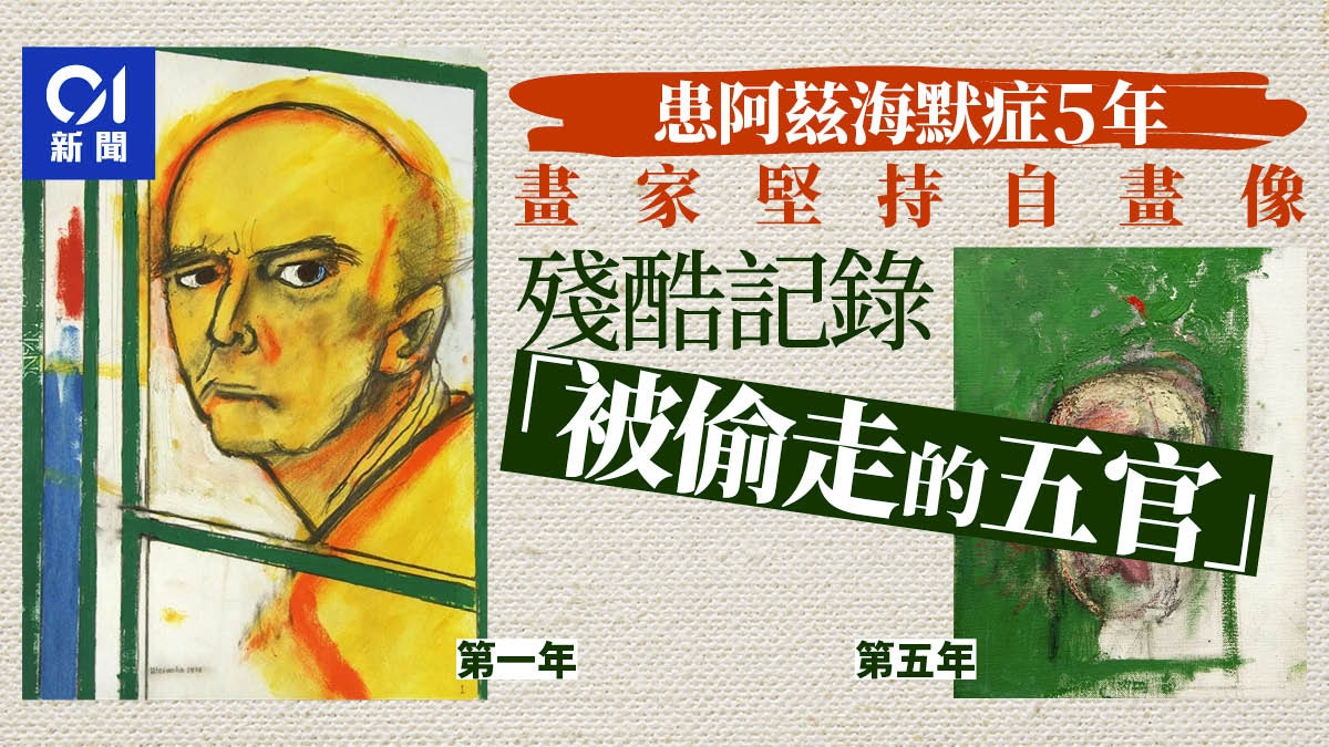 最残酷连载】画家以自画像记录阿兹海默症5年最后五官变这样