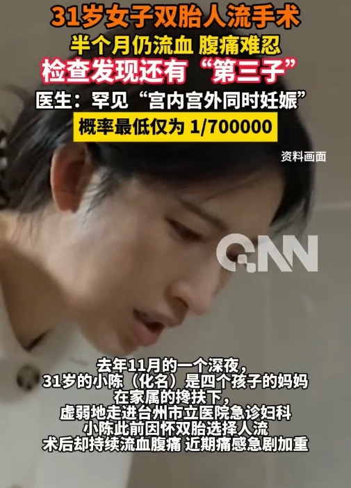31歲四孩媽又懷雙胞胎流產後腹痛半月送醫驚揭還有「第三胎」