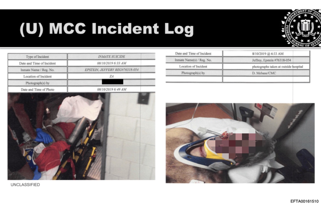 美國司法部2026年1月30日公布愛潑斯坦文件，照片來自號碼為「EFTA00161494」文件，其中可見愛潑斯坦自縊後面部充血變為紫紅色。（美國司法部）