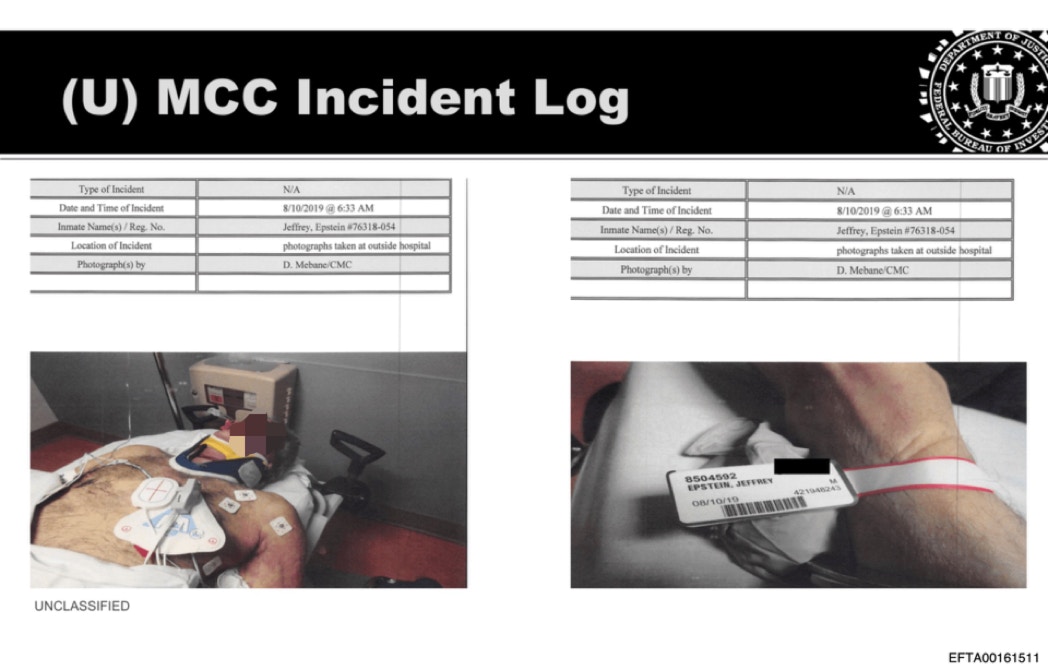 美國司法部2026年1月30日公布愛潑斯坦文件，照片來自號碼為「EFTA00161494」文件，其中可見愛潑斯坦接受急救。（美國司法部）
