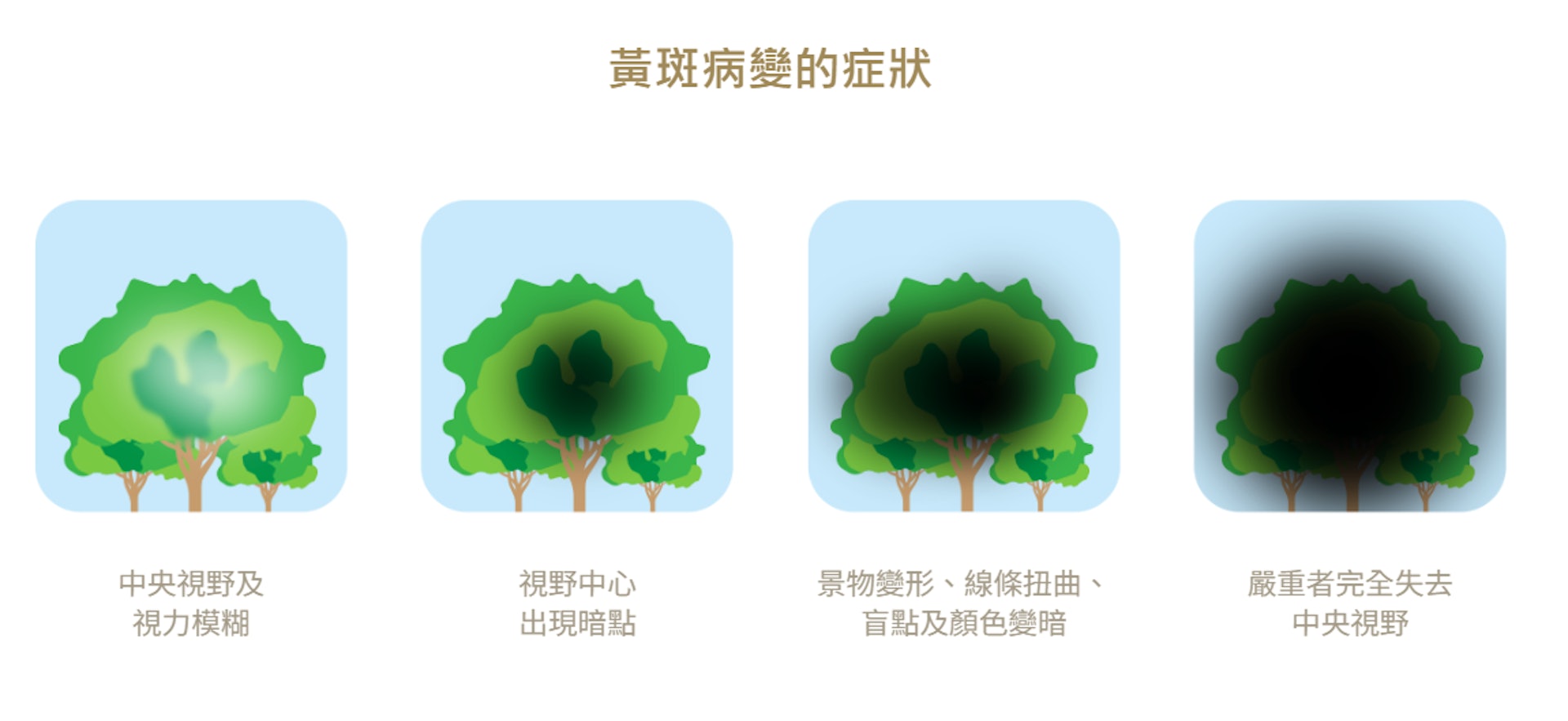 黃斑病變影響視力,嚴重者會導致視力完全喪失。