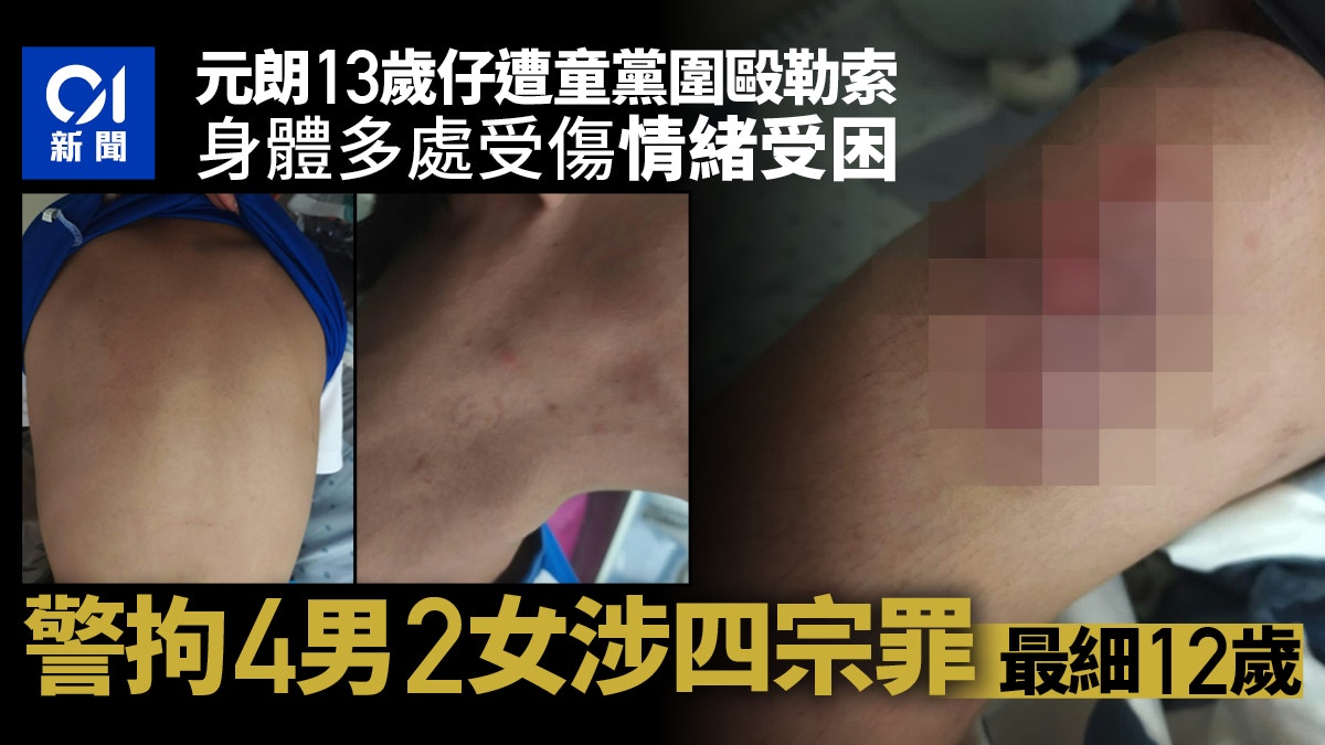 [社會正義與人性守護] 元朗童黨欺凌|13歲仔遭同學圍毆勒索 警拘6人涉四罪 最細12歲