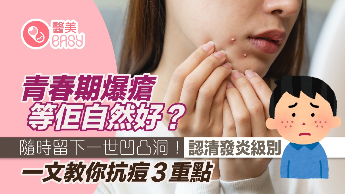 暗疮等青春期完会自动好？医生警告：错过黄金期恐留永久凹凸洞！