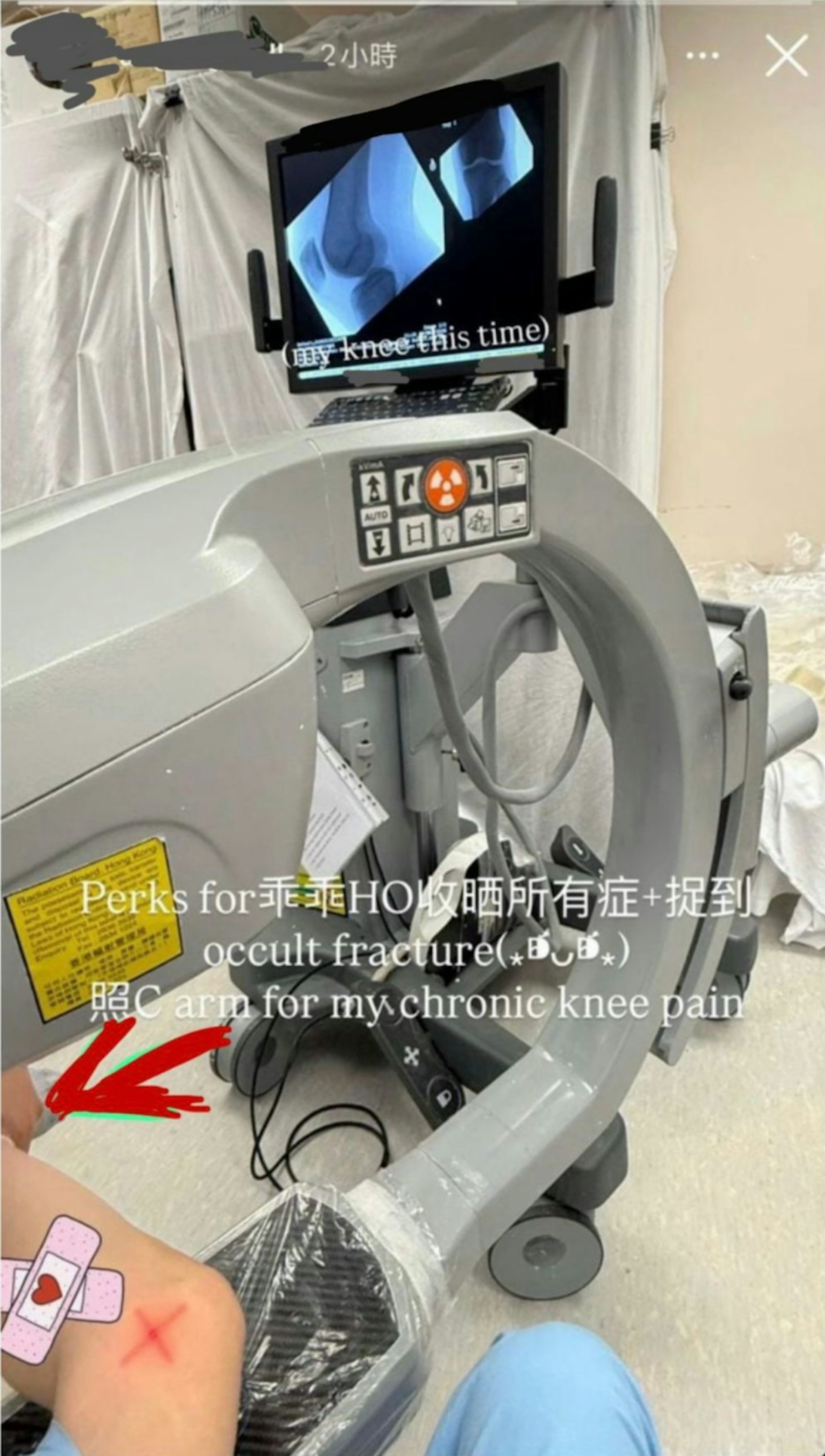 有網民於社交平臺Threads表示,一名女實習醫生在明愛醫院實習期間,在雜物房用C arm X光機照為自己照膝頭。(Threads@hlli_fe) 有網民於社交平臺Threads表示,一名女實習醫生在明愛醫院實習期間,在雜物房用C arm X光機照為自己照膝頭。(Threads@hlli_fe)