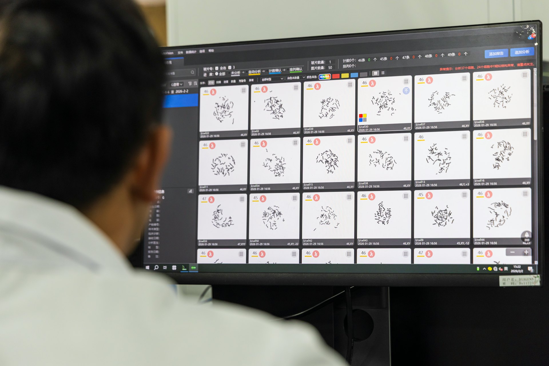 德适技术人员在对AutoVision®染色体核型分析系统进行测试。