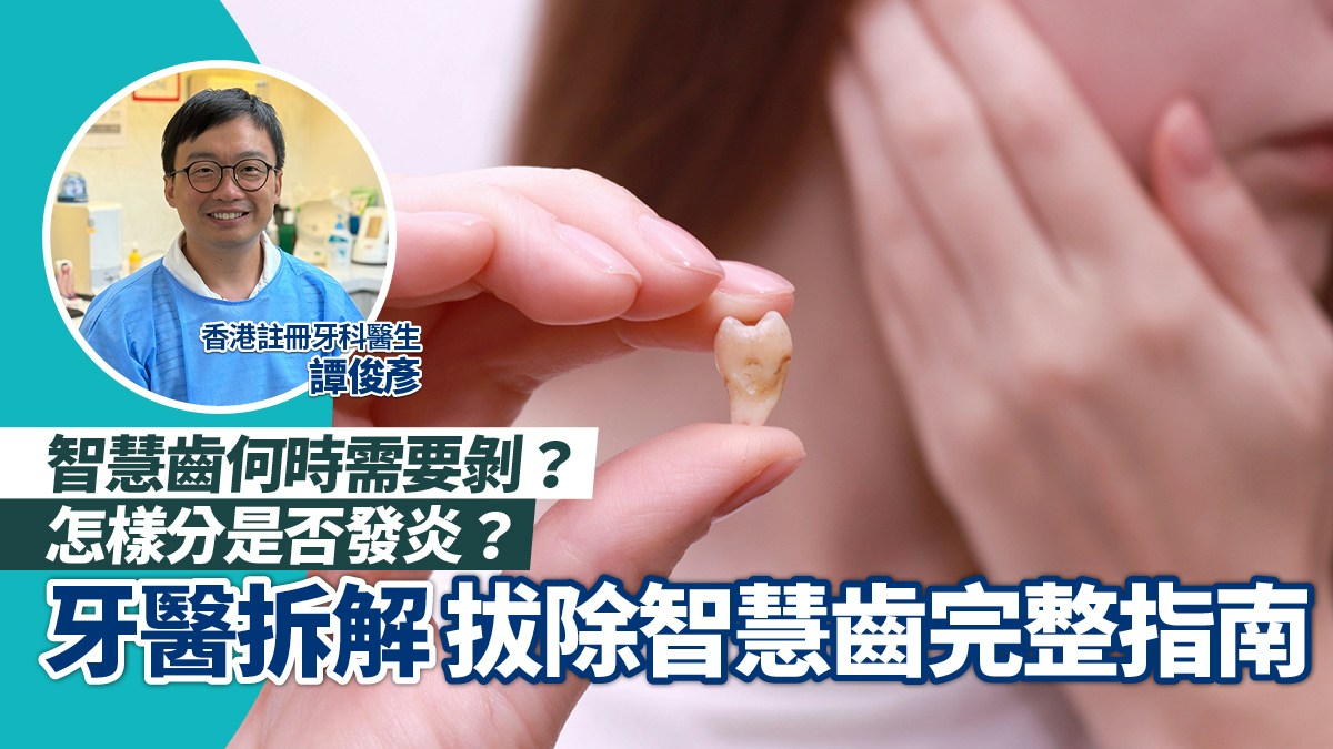 智慧齒何時需要剝?是否發炎?譚俊彥牙醫拆解拔除智慧齒完整指南