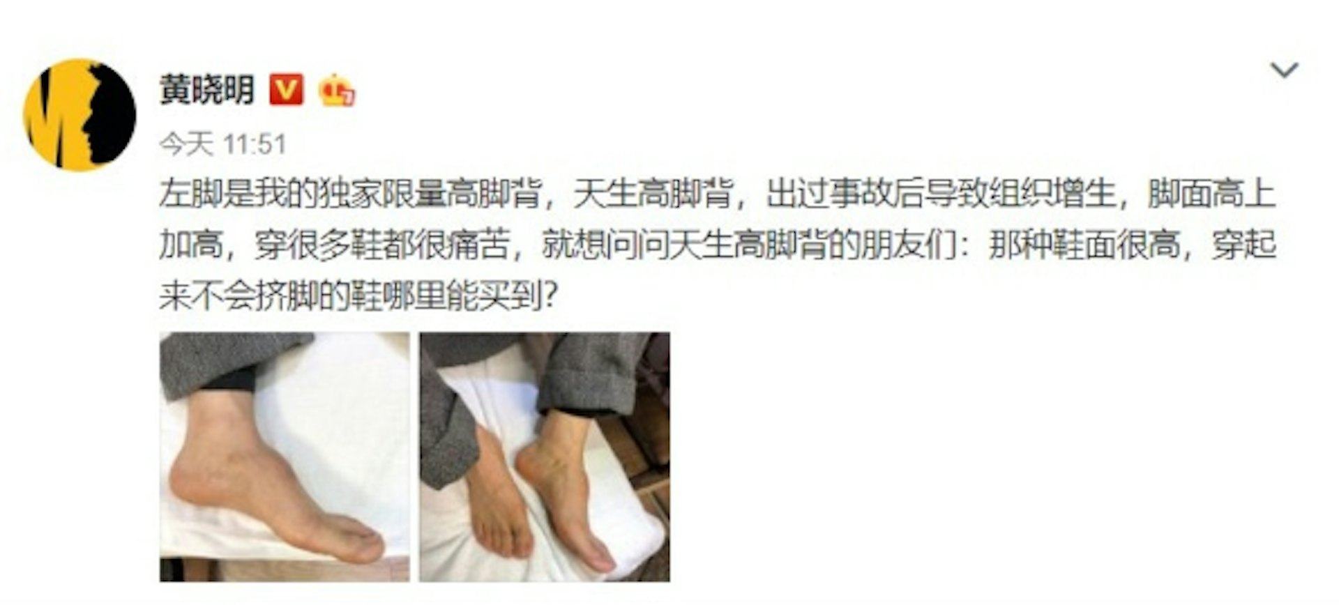 面对各种天马行空的无稽之谈,黄晓明不惜自己发微博脱鞋露脚背自证清白。