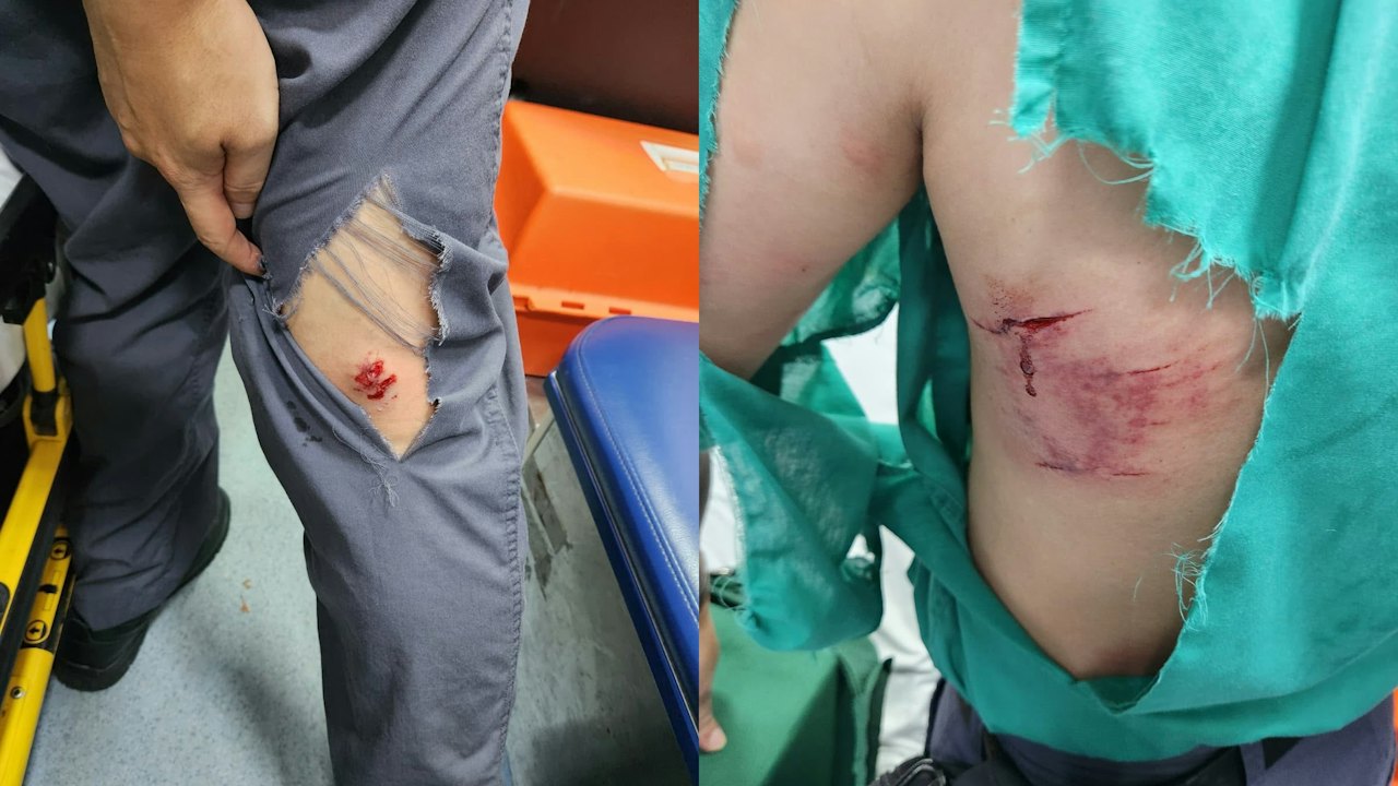 狗襲擊郵差|香港郵政:檢視需否優化現行預防被狗咬指引及裝備
